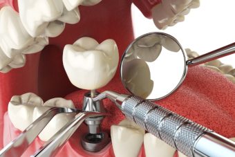 Mag dental (14)